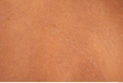 Photo Textures of Human Skin